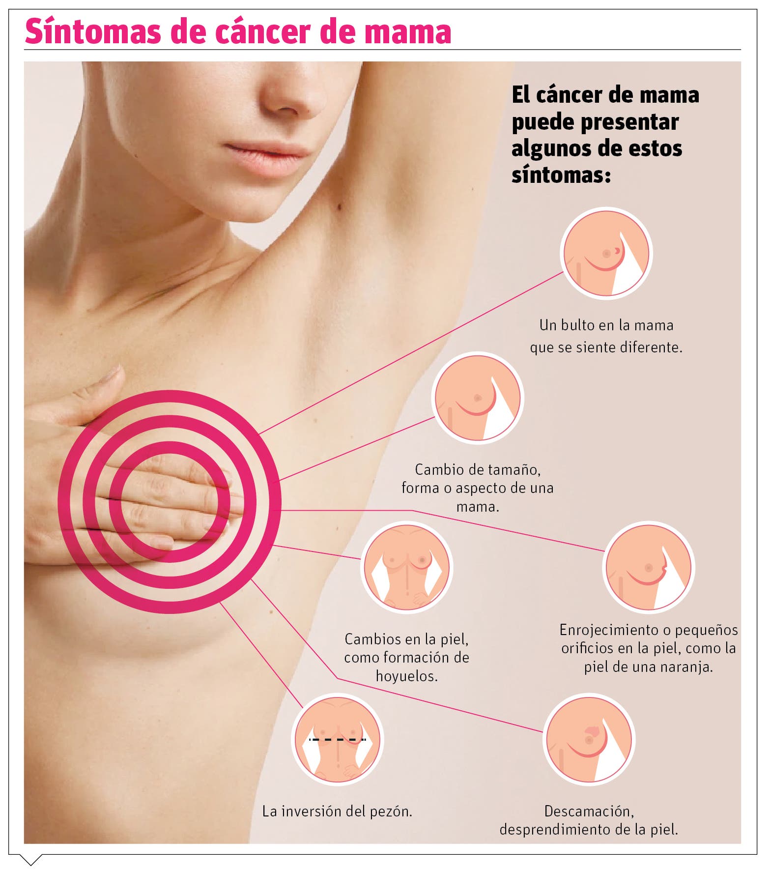 Estudios de cáncer de mama, ¿qué son y cómo acceder a ellos? Estudios de cáncer de mama, ¿qué son y cómo acceder a ellos?