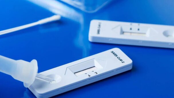 RD reporta 263 casos activos de coronavirus