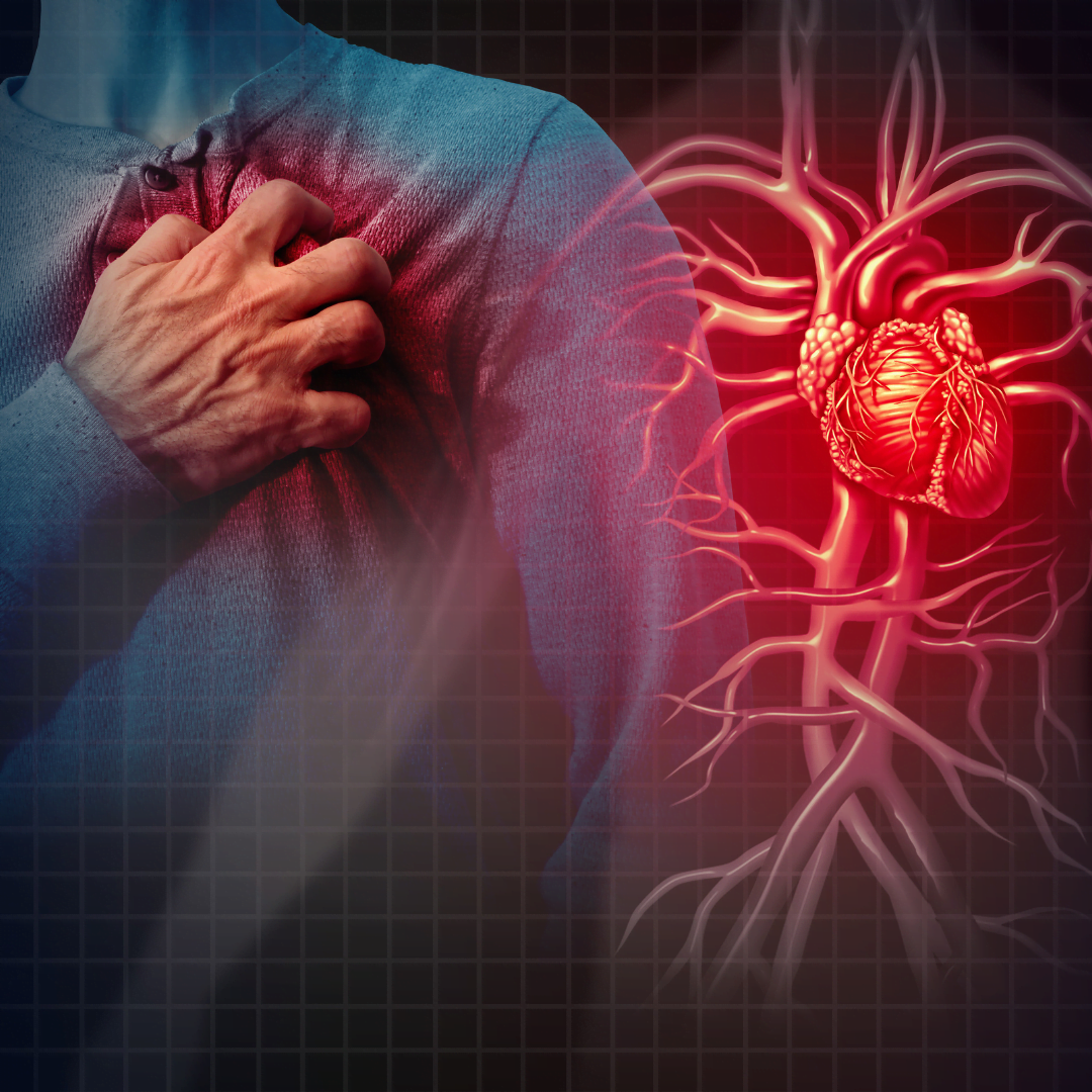 Revelan cardiopatías "subtratadas" en América Latina
