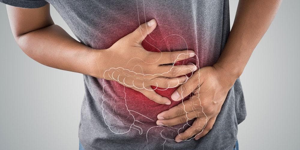 Alerta sobre aumento de cáncer de colon en jóvenes menores de 50 años Alerta sobre aumento de cáncer de colon en jóvenes menores de 50 años