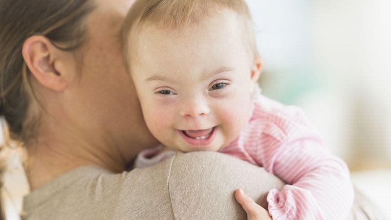 La drástica caída de nacimientos de bebés con síndrome de Down en Europa La drástica caída de nacimientos de bebés con síndrome de Down en Europa