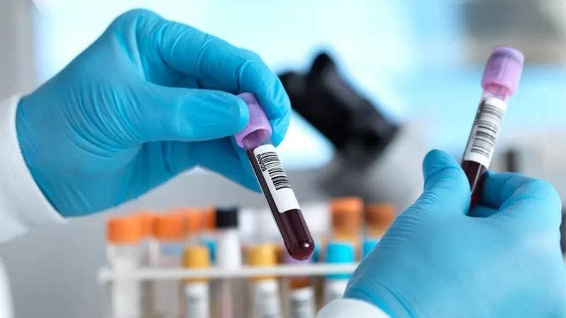 El prometedor análisis de sangre para el cáncer que ha entusiasmado a los científicos