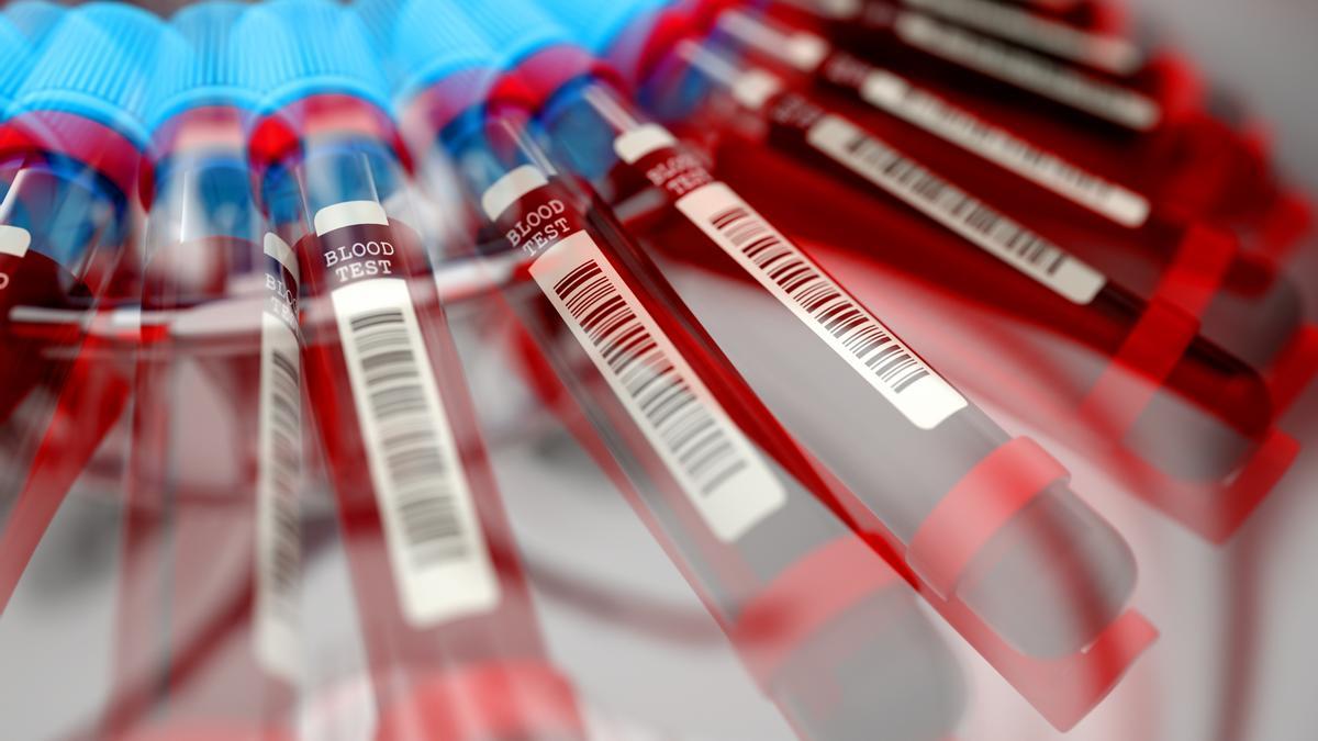Las víctimas del uso de sangre infectada en el Reino Unido reclaman una respuesta rápida al Gobierno Las víctimas del uso de sangre infectada en el Reino Unido reclaman una respuesta rápida al Gobierno