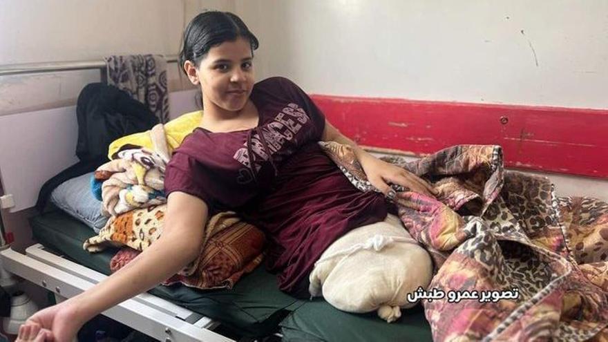 Dounia, la niña que perdió a sus padres en un bombardeo y ahora ha muerto en el hospital de Gaza por un obús