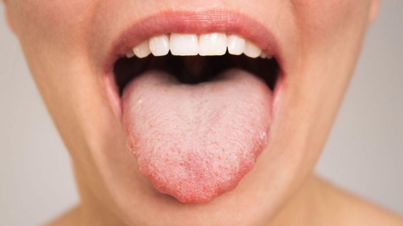 Cómo el patrón único de tu lengua puede influir en qué alimentos te gustan Cómo el patrón único de tu lengua puede influir en qué alimentos te gustan