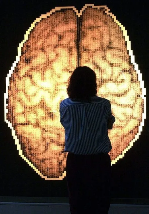Día Internacional de la Epilepsia: identificar síntomas más allá de las crisis