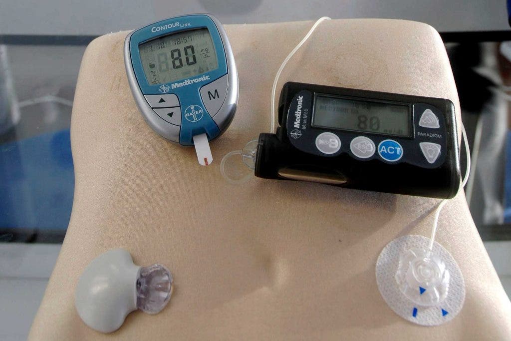 Expertos instan a dejar atrás el termino prediabetes por diabetes tipo 2 Expertos instan a dejar atrás el termino prediabetes por diabetes tipo 2