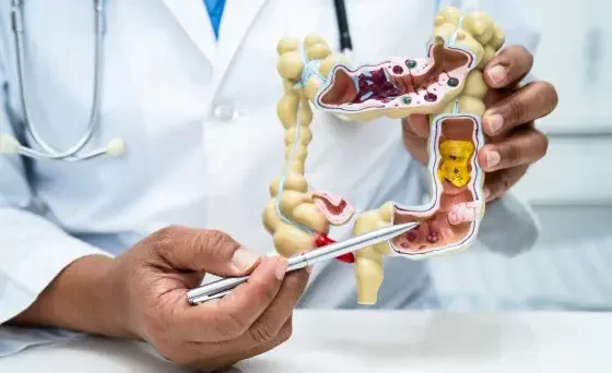 La detección temprana, la mejor opción contra el cáncer de colon en latinos, según Médicos
