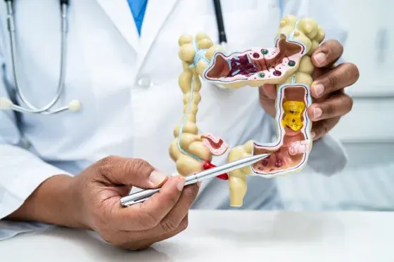 La detección temprana, la mejor opción contra el cáncer de colon en latinos, según Médicos La detección temprana, la mejor opción contra el cáncer de colon en latinos, según Médicos