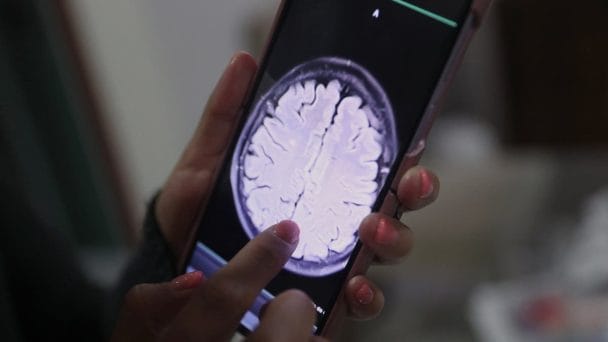 ¿Cómo la inteligencia artificial puede ayudar a leer las mamografías?