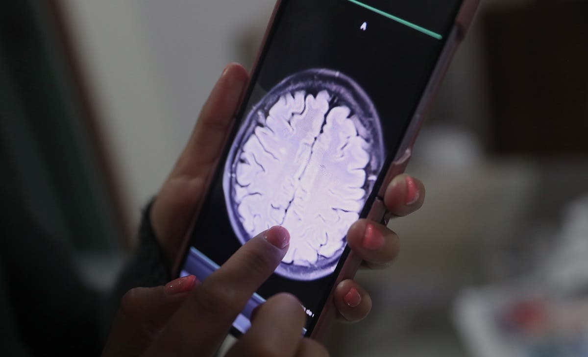 ¿Cómo la inteligencia artificial puede ayudar a leer las mamografías? ¿Cómo la inteligencia artificial puede ayudar a leer las mamografías?