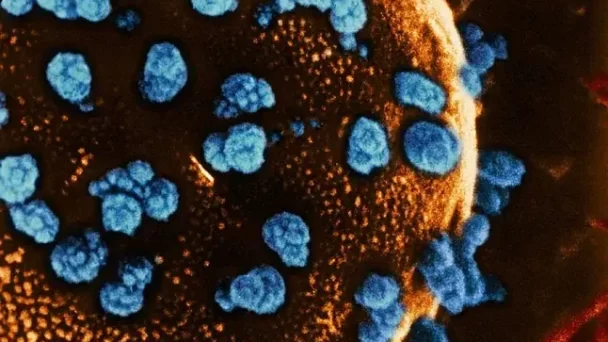 ‘Curan’ la diabetes tipo 1 en una mujer de 25 años tras un trasplante celular
