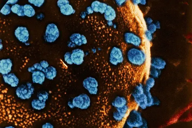‘Curan’ la diabetes tipo 1 en una mujer de 25 años tras un trasplante celular ‘Curan’ la diabetes tipo 1 en una mujer de 25 años tras un trasplante celular