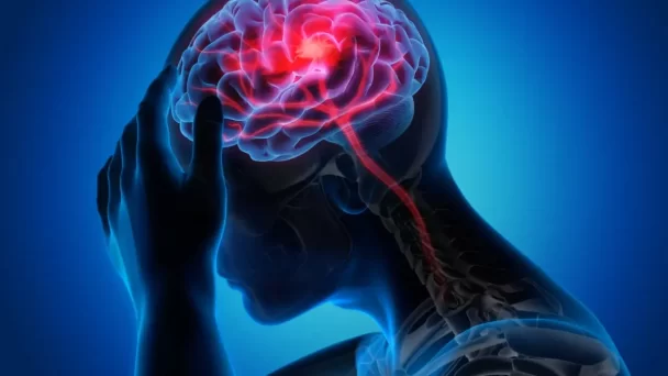 El linfoma cerebral primario, un tumor poco frecuente con síntomas inespecíficos